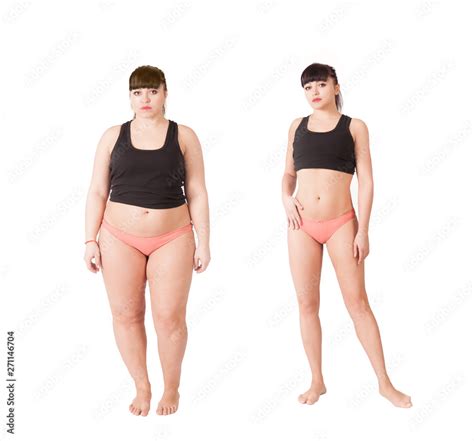 Before And After Losing Weight Comparison Of Fat And Thin Women Liposuction Results