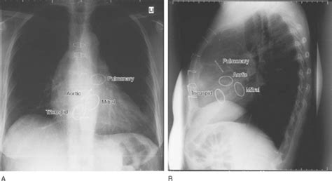 Chest Radiography Clinical Gate