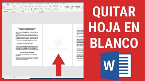 Como Insertar Una Hoja En Blanco En Word Otosection