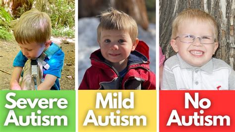 Signs Of Mild Autism Severe Autism No Autism Compared Youtube