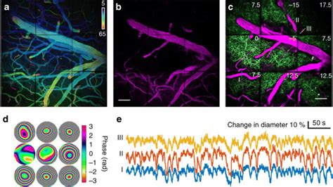 Non Planar Microscopy Of 3d Vasculature Dynamicsa Vasculature Network