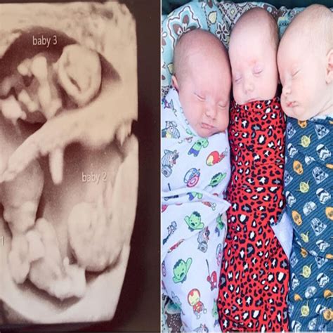 Triplets Mother Shares Incredible Before And After Pregnancy Photos