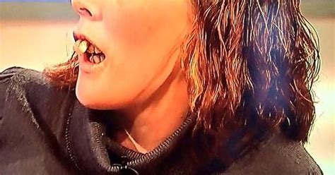 The Teeth Of The Jeremy Kyle Show Album On Imgur
