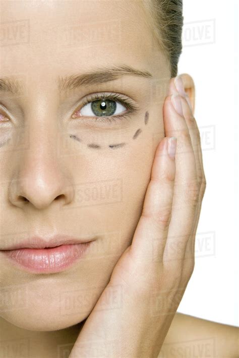 Woman With Plastic Surgery Markings Under Eye Holding Face Looking At
