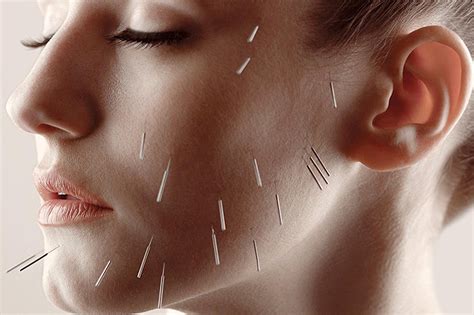 Facial Acupuncture New York Facial And Body Rejuvenation