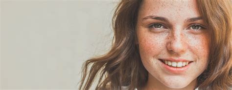 What Are Freckles Causes And Caring Tips Nivea