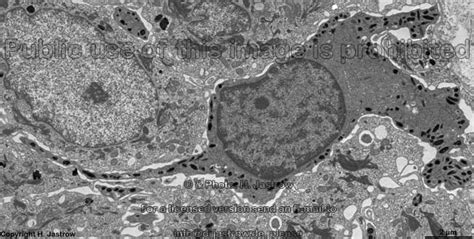 Pigment Cells Drjastrows Electron Microscopic Atlas