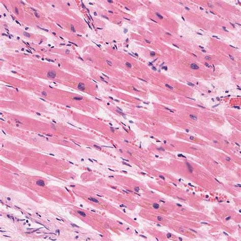 Muscle Tissue Histology Study Guide Kenhub