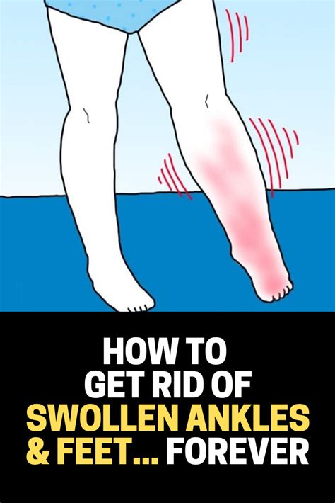 How To Get Rid Of Swollen Ankles And Feet Health And Beauty Tips