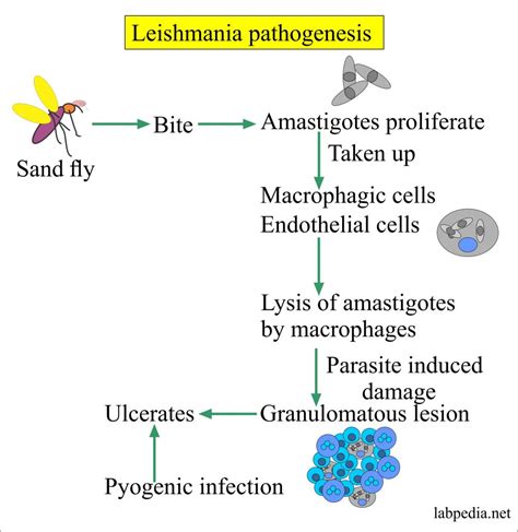 Leishmaniasis Cutaneous Leishmaniasis And Visceral Leishmaniasis Oriental Sore And Kala Azar