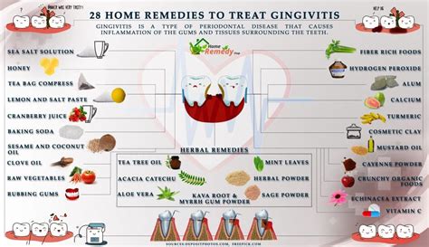 28 Home Remedies To Treat Gingivitis Home Remedies