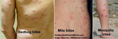 Red Spots On Skin Causes Treatments And More Extensive Guide