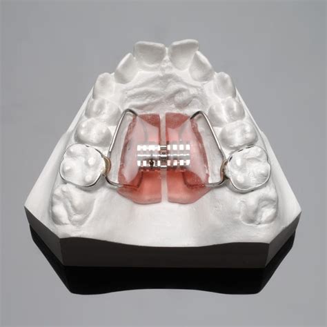 Palatal Expander Orthodontic Specialists