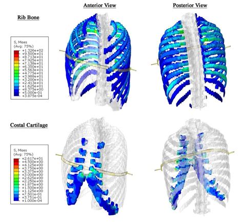 Contour Plots Of Von Mises Stress Experienced By The Thorax Before And