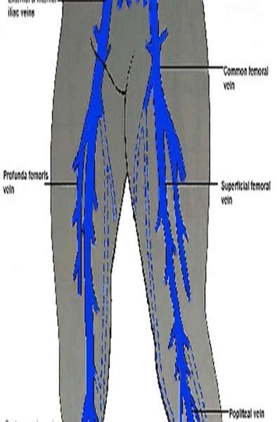 Print Bilateral lower extremity flashcards | Easy Notecards