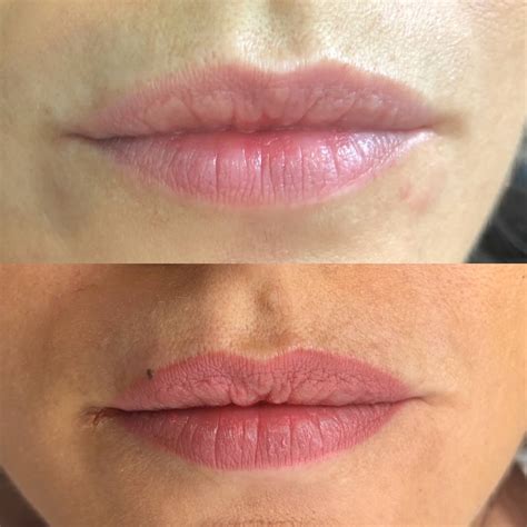 Maquillage Permanent Lèvres Avant Après Myriam H