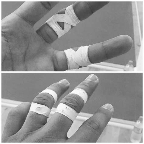 Finger Tape Knows Jiu Jitsu How Do You Tape Heres An Example Of