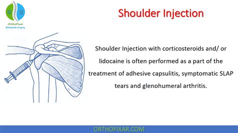 Shoulder Injection Posterior Approach