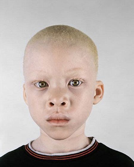 Albino Black People Gallery Ebaums World