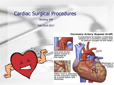 Ppt Cardiac Surgical Procedures Powerpoint Presentation Free