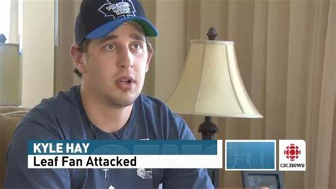 Leafs Fan Recovering After Being Knocked Out In Boston Cbc News