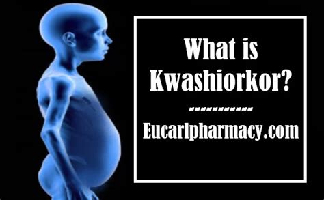 Kwashiorkor Definition Symptoms Causes And Treatment
