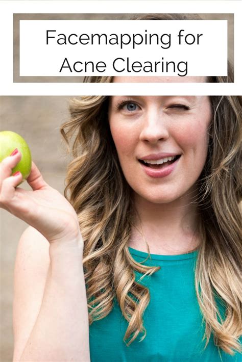 Facemapping For Acne What You Should Know Facemapping Acneclearing