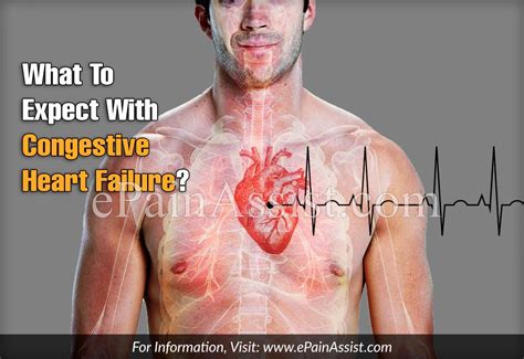 What To Expect With Congestive Heart Failure