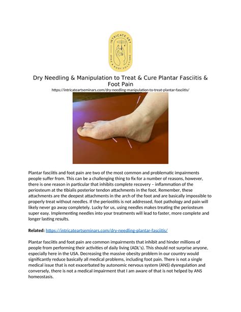Pdf Dry Needling And Manipulation To Treat And Cure Plantar Fasciitis