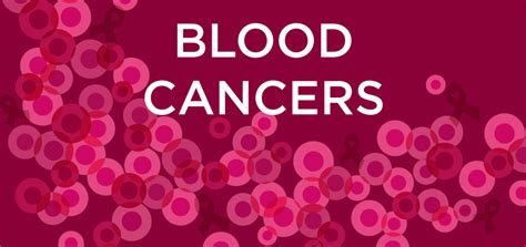 Get The Facts On Blood Cancers Shine365 From Marshfield Clinic