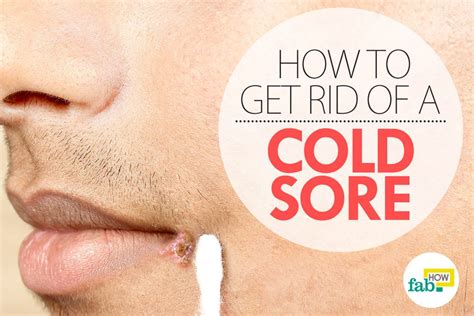How To Treat Fever How To Get Rid Of Cold Sores Quickly Healdove