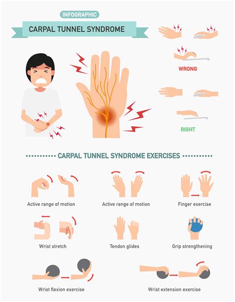 Carpal Tunnel Syndrome Causes Symptoms And Treatment