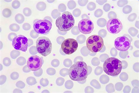 Polymorfonucleaire Leukocyten Witte Bloedcellen Med Nl