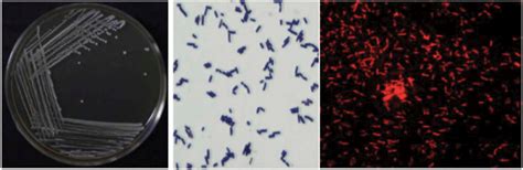A Colony Formation Of Bifidobacterium Animalis On Mrsa Media 15 Mm