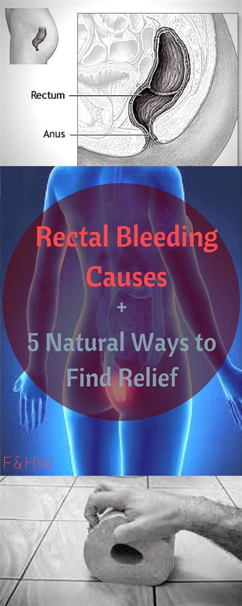 Rectal Bleeding Causes 5 Natural Ways To Find Relief Health And Wellbeing Rectal Bleeding