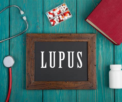 Lupus Sle Qualmedica Research