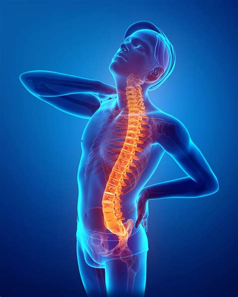 Herniated Disc Sol Physical Therapy Performance