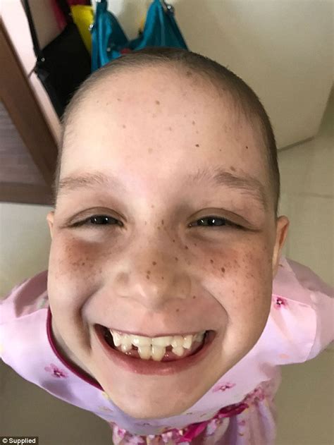 If you are taking chemo drugs that cause hair loss it is most likely that you will begin losing your hair after you have undergone a few treatments, as hair loss usually doesn't happen immediately. Girl left with single eyelash after chemo hair grows back ...