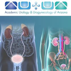 Aquablation Therapy For Bph Enlarged Prostate Academic Urology Urogynecology Of Az
