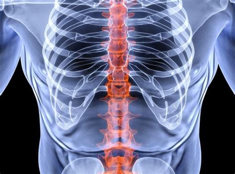 Spinal Fusion Surgery For Lower Back Pain Its Costly And Theres