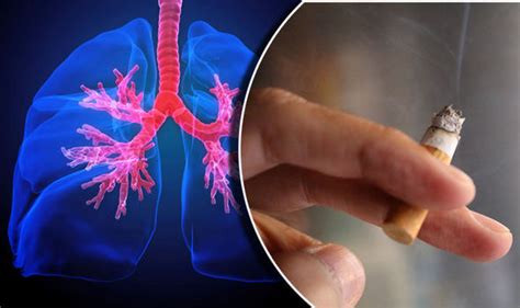your ‘smoker s cough could be sign of potentially life threatening emphysema uk