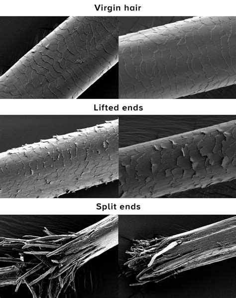 Curly Hair Under A Microscope Image Curly Hair