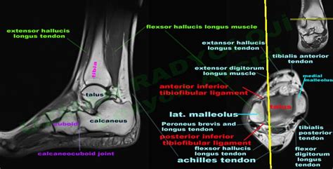 The muscular system is made up of specialized cells called muscle fibers. MRI ankle - Google Search | Foot anatomy, Mri, Anatomy images