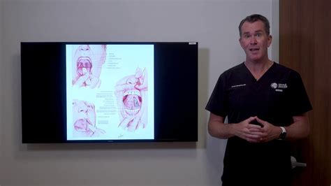 Pediatric Snoring Upper Airway Resistance Syndrome Youtube