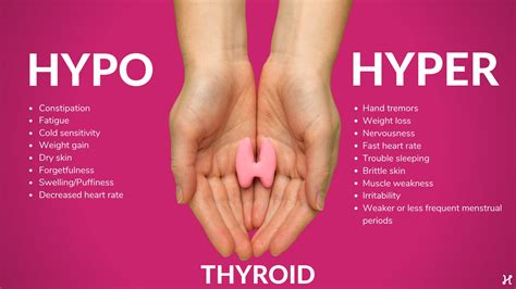 An Emerging Treatment For Thyroid Nodules Sb Magazine
