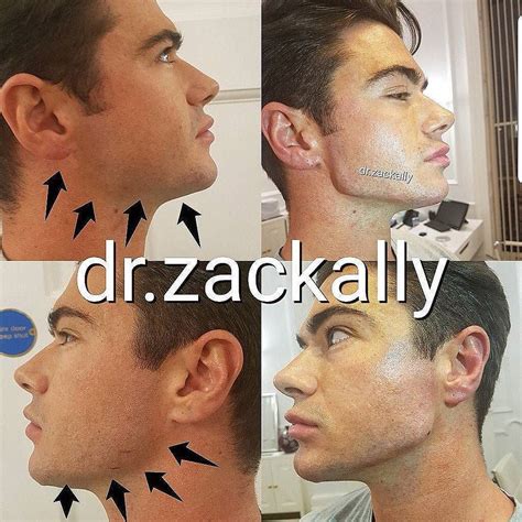Masculinisation Learn How To Artistically Sculpt A New Jawline In 10