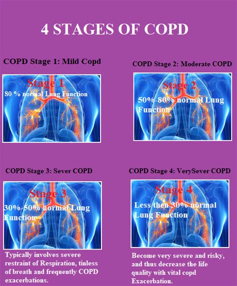 However, this stage can also describe an early stage of oa when damage is beginning to occur on a cellular level, without clinical signs or symptoms. 4-stages-of-copd - Medical eStudy
