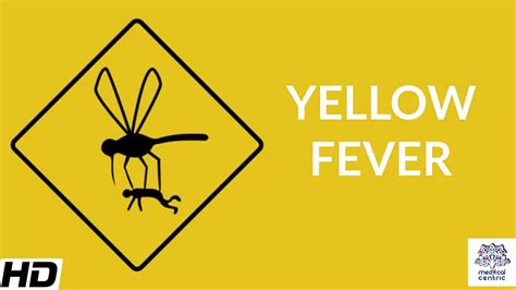 Yellow Fever Causes Signs And Symptoms Diagnosis And Treatment