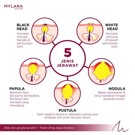 Find out if the mylara skincare 4 in 1 collagen cleanser is good for you! 5 MASALAH KULIT YANG KORANG KENA AMBIL TAHU - MYLARA Skincare