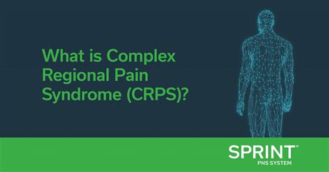 Understanding Complex Regional Pain Syndrome Crps Spr Therapeutics